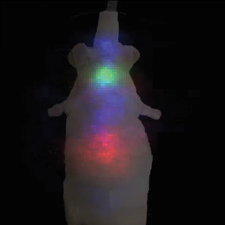 医療ガンマ線イメージング